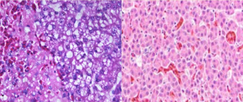 HỘI CHỨNG XUẤT HUYẾT GAN NHIỄM MỠ TRÊN GIA CẦM - Công ty CP Thiên Quân